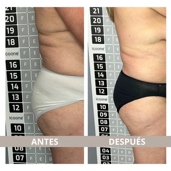 Masajeador profesional con infrarrojo 4 en 1.